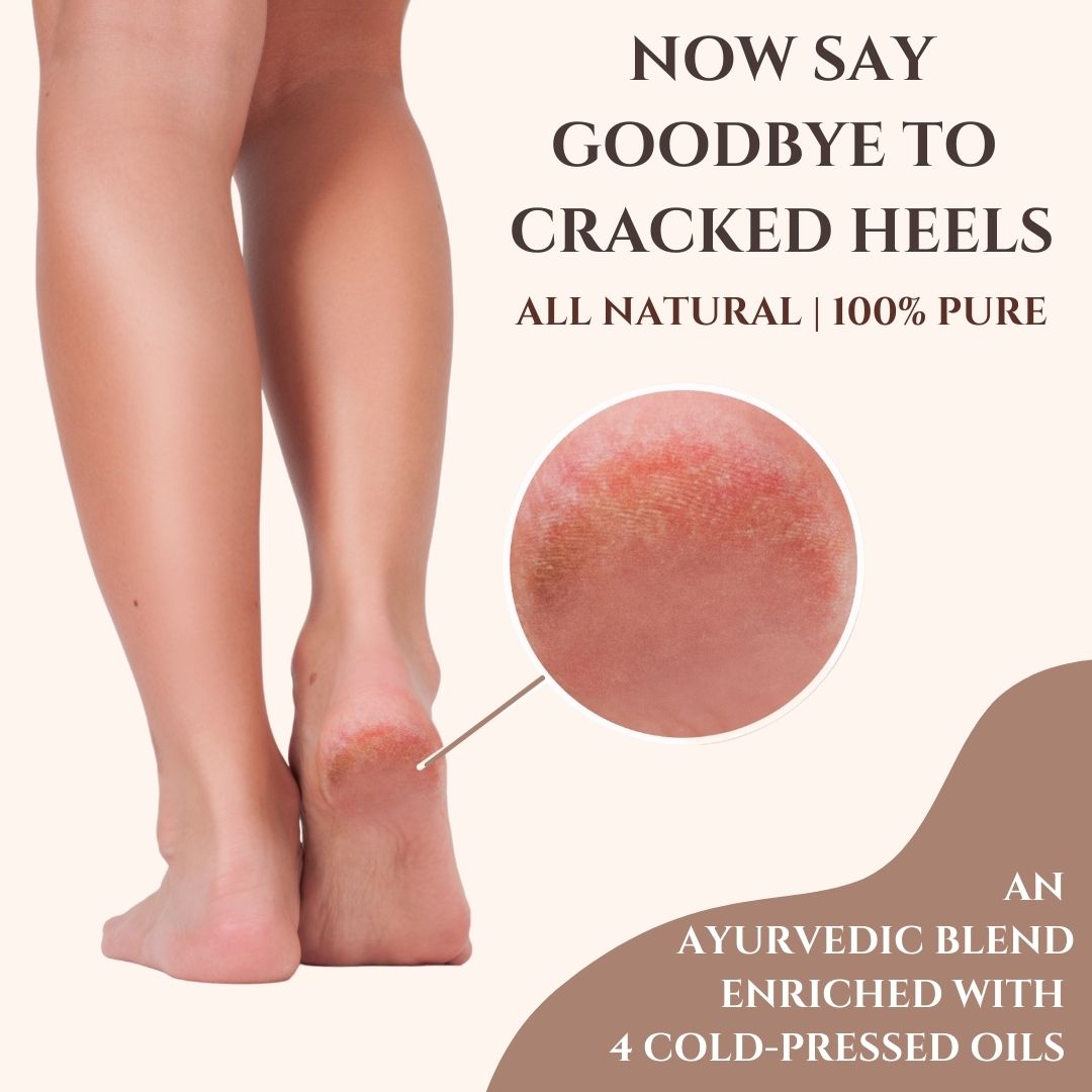 Natural cracked heel on sale repair